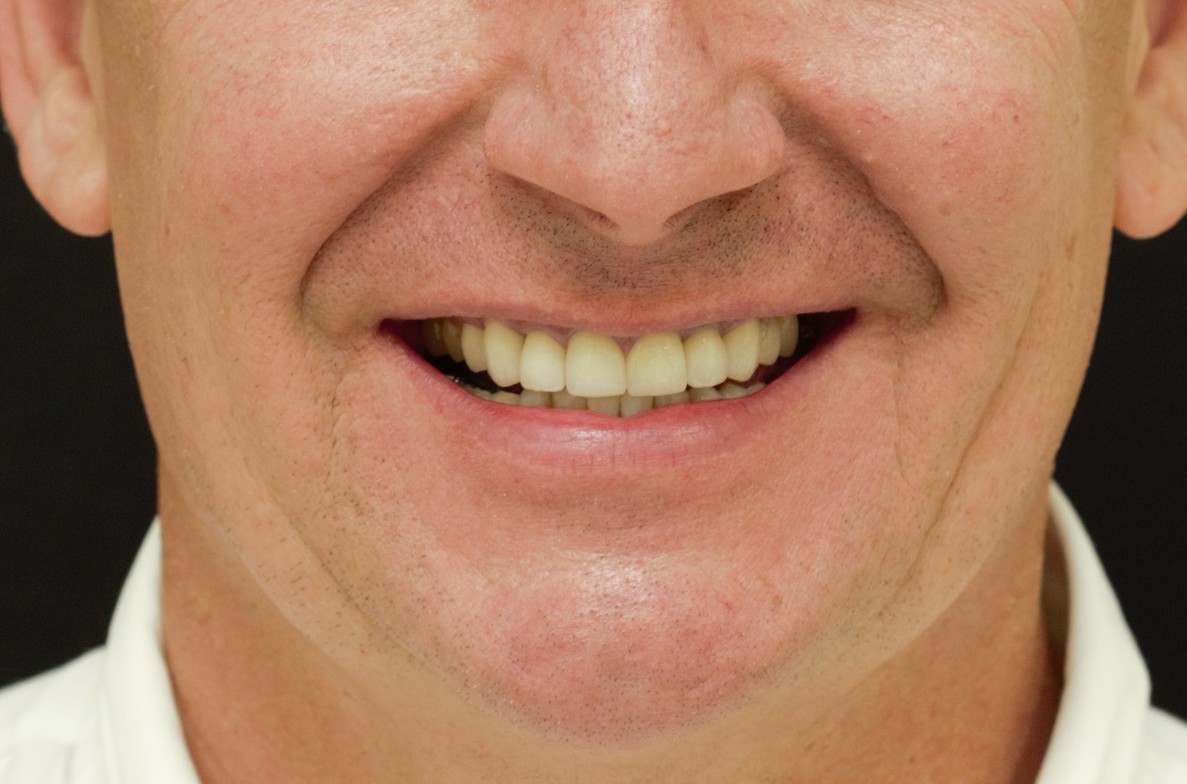 Slideshow image