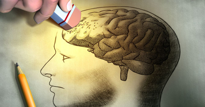 Excessive Daytime Napping Can Be An Early Sign of Alzheimer’s Disease image