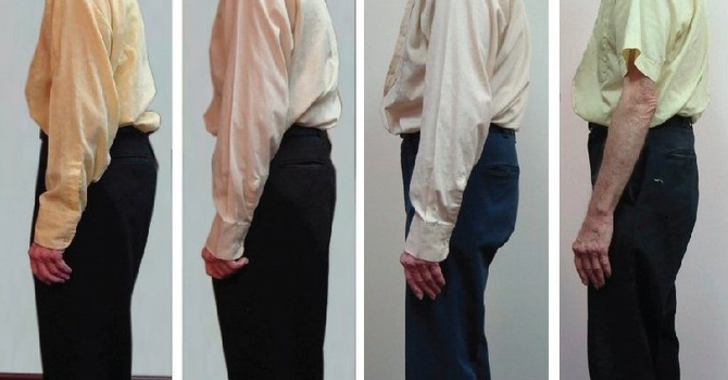 3 Signs You Brain May Be in Trouble image